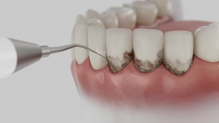Trusted Tooth Extraction service in Dunn, NC - Dentist Open Now